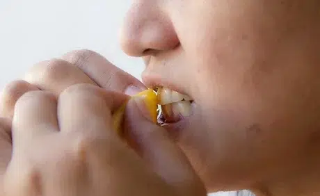 Blanquear Dientes con Cáscara de Naranja: Método Natural para una Sonrisa Radiante 1 blanquear los dientes con naranja 2 e1709828181414